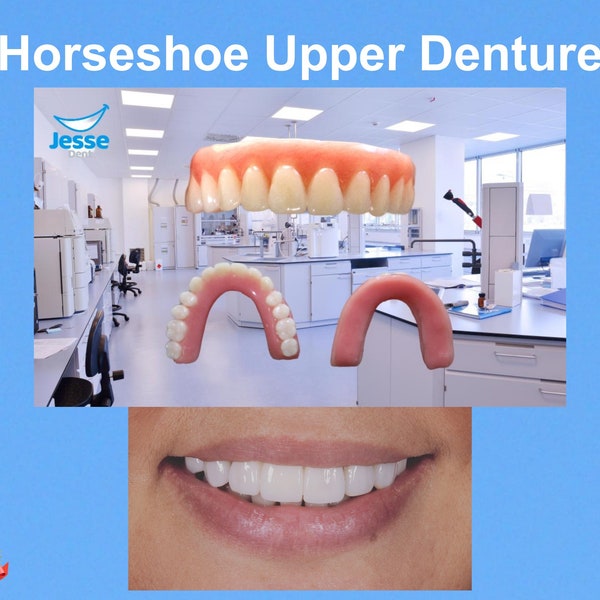 Horseshoe Upper Dentures Etsy