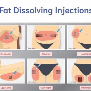 Mesoterapia estética