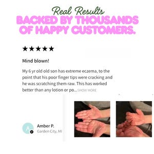 Pu&ograve; includere: Immagine con testo: "Real Results BACKED BY THOUSANDS OF HAPPY CUSTOMERS." Una recensione del cliente descrive l'efficacia di un prodotto per l'eczema di un bambino. La recensione include una valutazione a 5 stelle e una foto di mani.