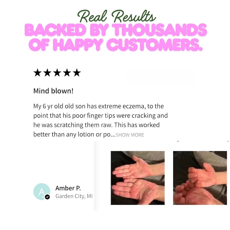 Pu&ograve; includere: Immagine con testo: "Real Results BACKED BY THOUSANDS OF HAPPY CUSTOMERS." Una recensione del cliente descrive l'efficacia di un prodotto per l'eczema di un bambino. La recensione include una valutazione a 5 stelle e una foto di mani.