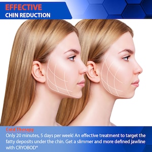 V Shaped Slimming Face Mask Double Chin Reducer V Line Lifting Mask Neck  Lift Tape Face Slimmer Patch Chin Strap For Women Jawline Sculptor For  Firming and Tightening Skin 5 and 10