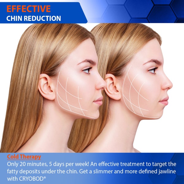 CRYOBOD Double Chin Face Slimming Wrap–Premium Fat Freezing Chin Reducer, Cold Face Slimmer Wrap–Targets Stubborn Chin & Neck Fat, Tone Skin