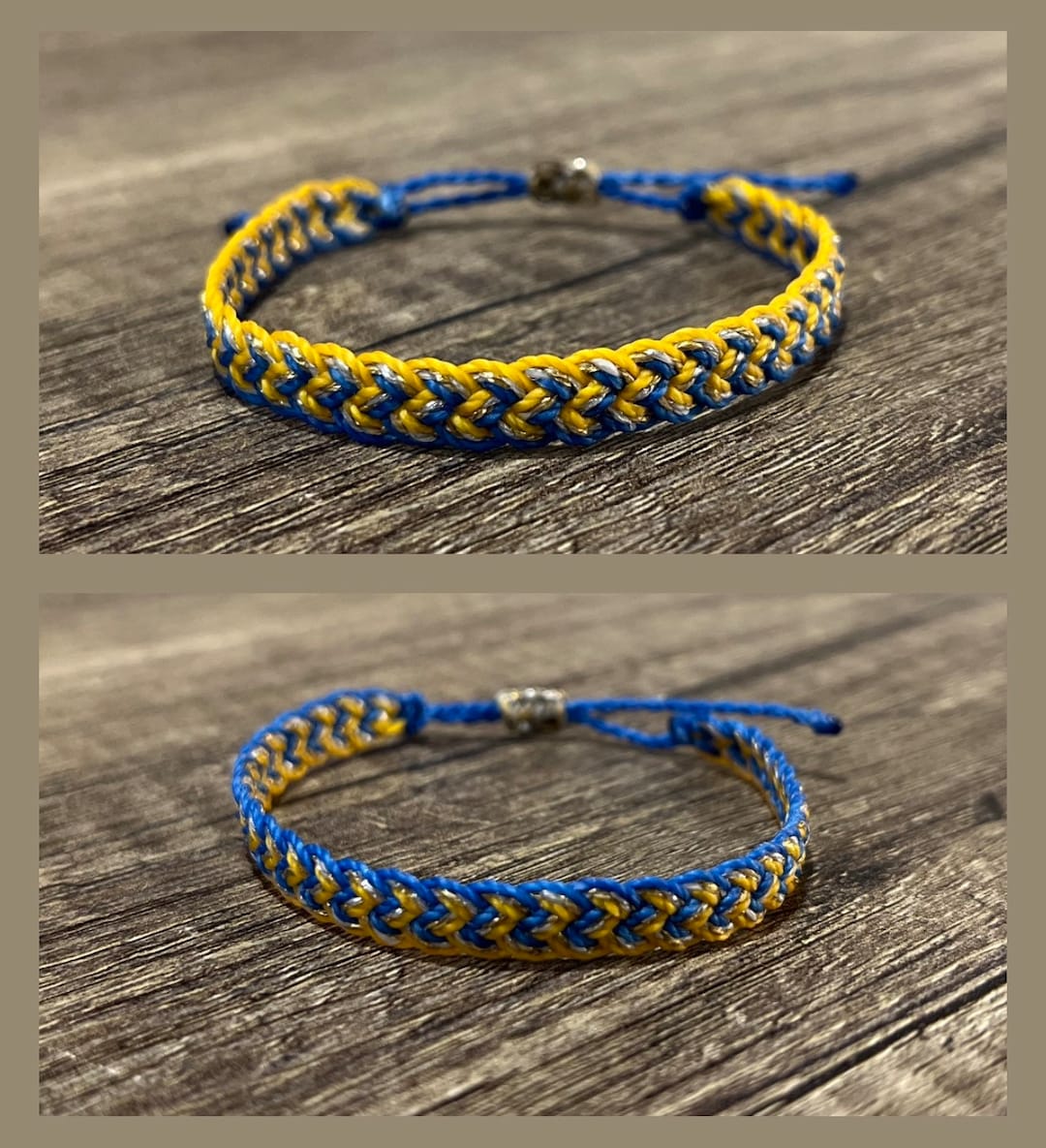 Sindrome Down, A Roma La Conferenza Internazionale - Foto 2