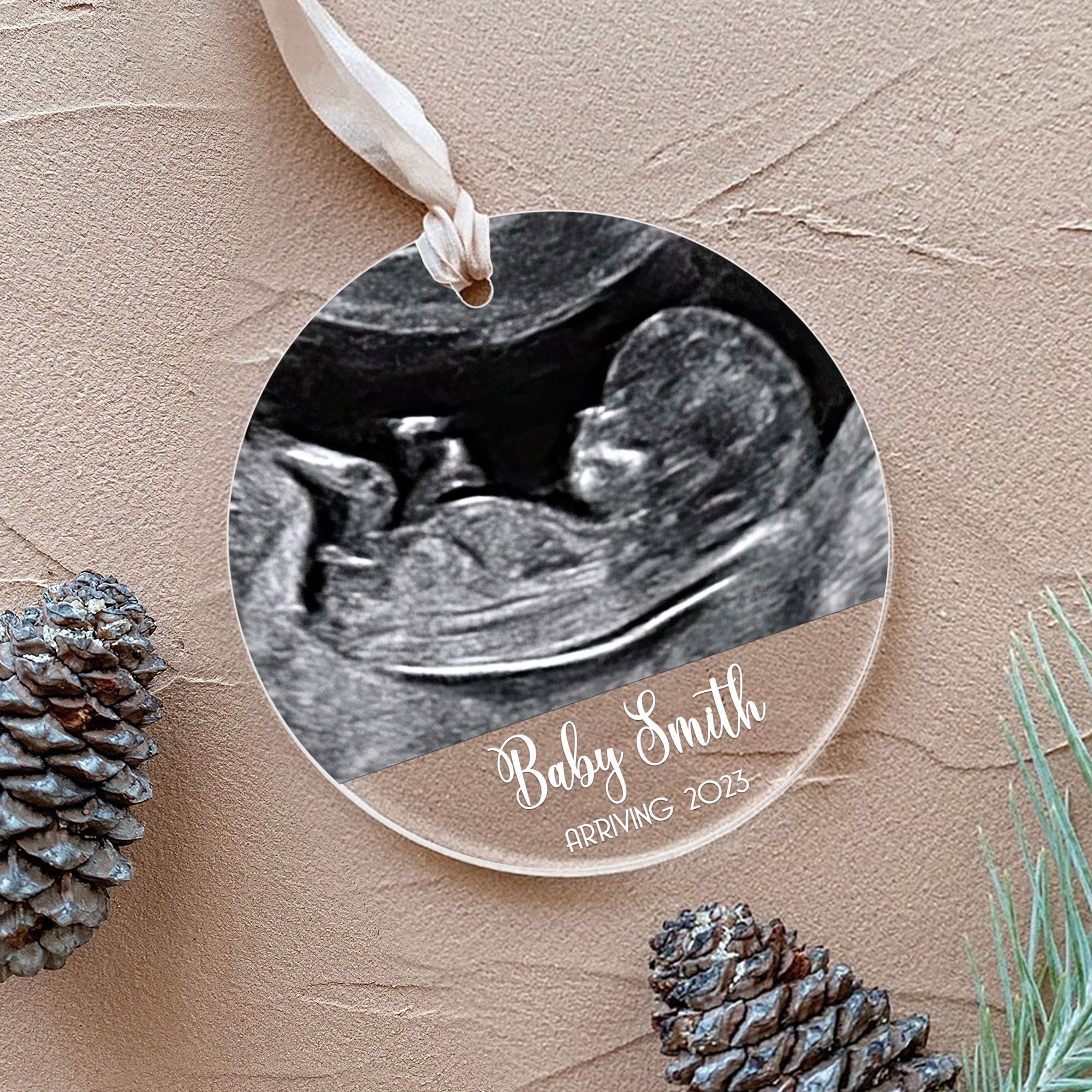 Baby Ultrasound Ornament Baby Announcement Ornament Etsy