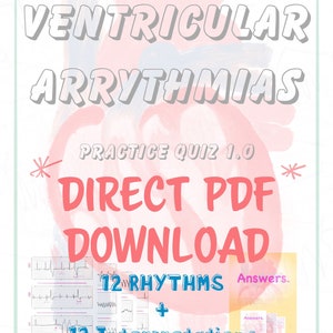 Ventricular Arrhythmia Practice Quiz 1.0: EKG MASTERY for Nurses