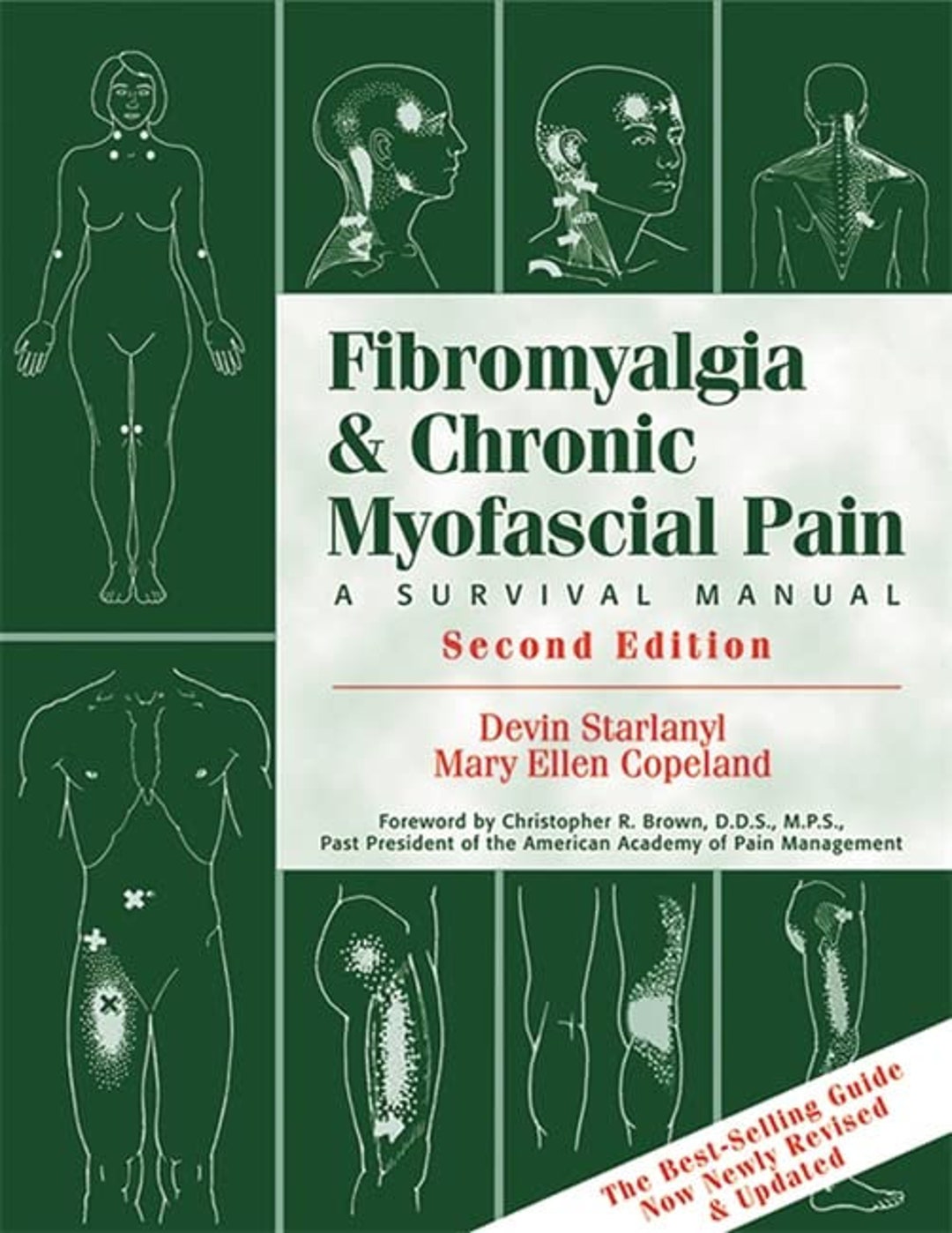 Myofascial physiotherapy device user manual инструкция. Myofascial pain syndrome fibromyalgia. myofascial physiotherapy device user manual инструкция на русском.