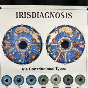 May include: A poster labelled "IRISDIAGNOSIS" displays two detailed diagrams of irises, each with internal organ illustrations. The poster includes a clock-like layout around the iris and examples of various iris constitutional types.