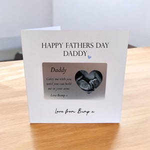 Tarjeta con billetera de aluminio de recuerdo extraíble, Feliz cumpleaños, papá, personalizada con la ecografía de tu bebé para el cumpleaños de papá.