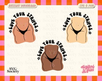 May include: Three digital illustrations of a body with stripes, each with the text "*LOVE YOUR STRIPES*" in a black, rounded font.