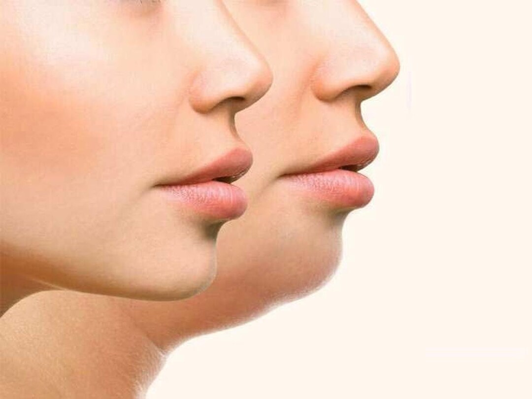 Lose Face Fat Spell Remove Jowls Turkey Neck Fat And Excess Etsy lose-face-fat-spell-remove-jowls-turkey-neck-fat-and-excess-etsy