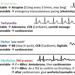 Cardiac Rhythms Cheat Sheet