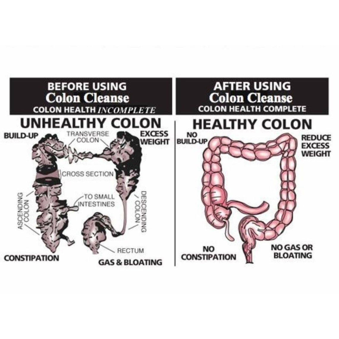 Mucoid Plaque Colon Cleanse Etsy