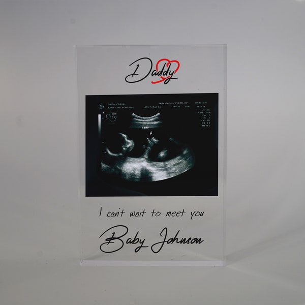 Baby Ultrasound Scan Print Acrylic Block, Sonogram Gift, Pregnancy Gift, Baby Shower Gift, Grandparents to be Gift, Promoted to Grandparents