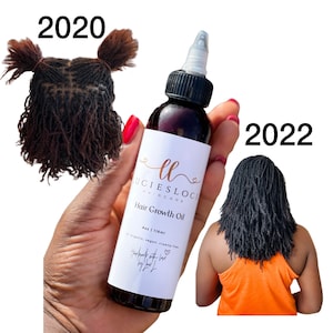 Hair Growth Oil | All Organic Herbs, Helps With Hair Loss, Thicker Hair, Hot Oil Treatment, Dry Itchy Scalp, Vegan,Cruelty free | Hair Care