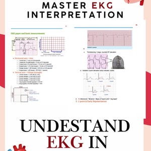 Puede incluir: Una infografía educativa titulada MASTER EKG INTERPRETATION y UNDERSTAND EKG IN DEPTH. Incluye diagramas de mediciones de papel ECG, el eje horizontal del tiempo, el eje vertical de voltaje, ondas de Wellen y elevación del punto J con corazones.