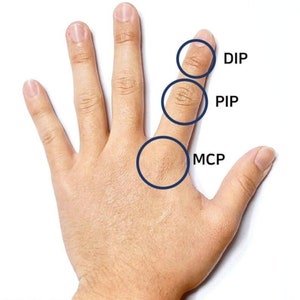 May include: A close-up of a hand with three circles drawn on the fingers. The circles are labeled "DIP", "PIP", and "MCP".
