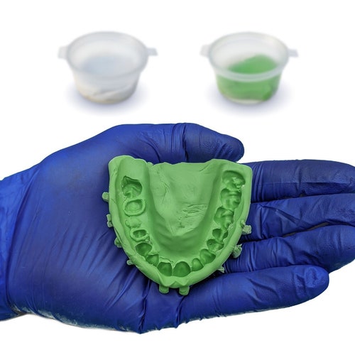 Athome Dental Impression Kit Partial Dentures Flexible Etsy