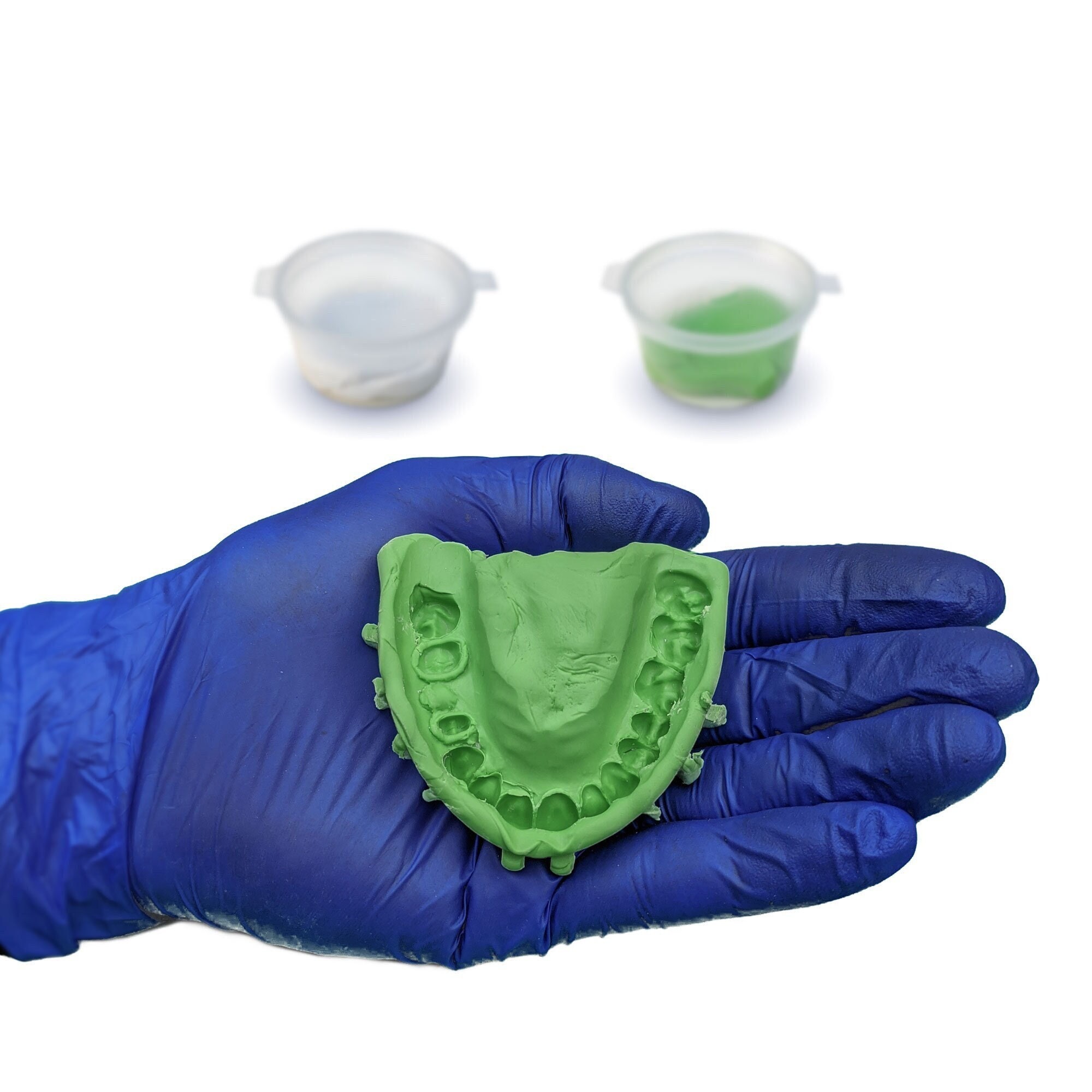 DIY Dental Casting Kit - Silicone Putty Teeth Impression