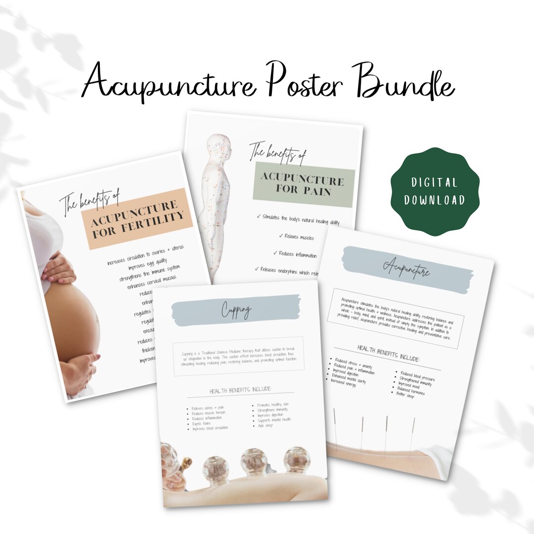 Bundle of Four (4) Acupuncture Printable Posters, Acupuncture Digital ...