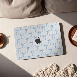 Cute Blue Bows Macbook Case 2025 New Protective Case Laptop Cover for Macbook Air 15/13, Macbook Pro 13/14/15/16 Inch 2024 M4 M3 M2 2022