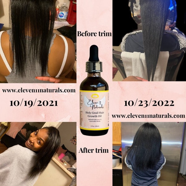 Alopecia Treatment Etsy