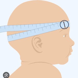 Pode incluir: Ilustra&ccedil;&atilde;o da cabe&ccedil;a de um beb&ecirc; com uma fita m&eacute;trica azul clara enrolada em volta da cabe&ccedil;a. A fita &eacute; marcada com incrementos em cent&iacute;metros. Um c&iacute;rculo preto destaca o ponto de medi&ccedil;&atilde;o na testa do beb&ecirc;.