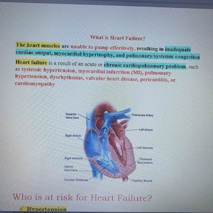 Può includere: Diagramma del cuore umano che mostra le camere, le valvole e il flusso sanguigno. Il diagramma include anche del testo che spiega cos'è l'insufficienza cardiaca e chi è a rischio di insufficienza cardiaca. Il testo afferma che l'insufficienza cardiaca è il risultato di un problema cardiopolmonare acuto o cronico, come l'ipertensione sistemica, l'infarto del miocardio (IM), l'ipertensione polmonare, le aritmie, la malattia valvolare cardiaca, la pericardite o la cardiomiopatia. Il testo afferma anche che l'ipertensione è un fattore di rischio per l'insufficienza cardiaca.