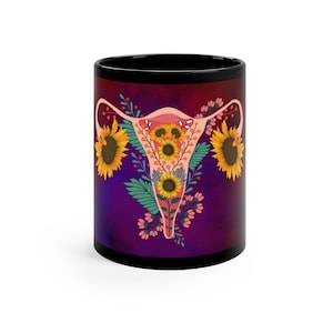 Mug, Custom Mugs, Uterus, Feminist Mug, Uterus Art, Female Anatomy