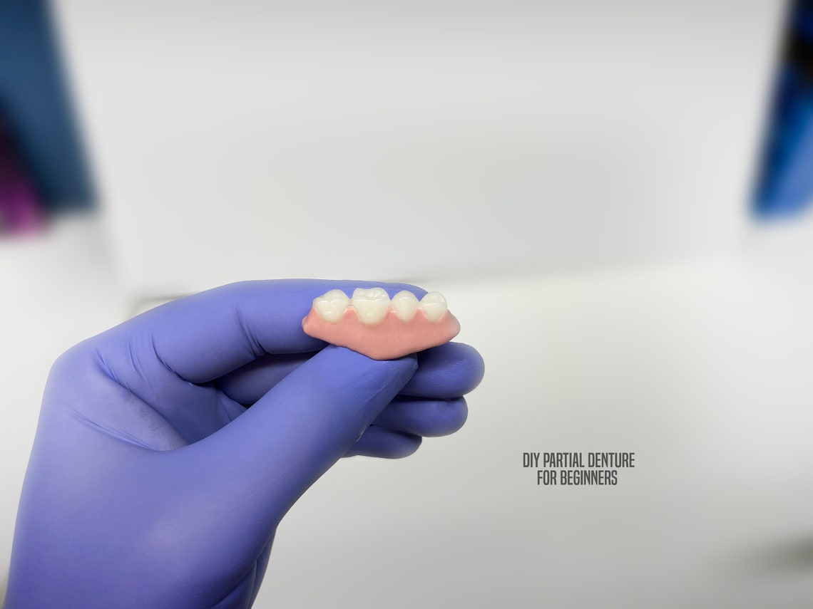 DIY Partial Denture Kit Putty Impressions Plaster and All Etsy