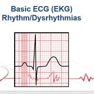 EKG Study Guide with over 100 pages of Dysrhythmia images