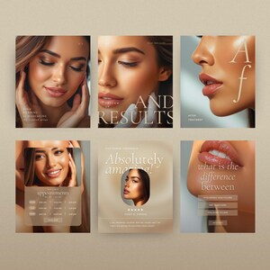 Esthetician Templates Filler Posts Botox Templates Luxury Nurse Injector Templates Flyer MedSpa Skincare Instagram Instagram for Estheticians Skincare Instagram templates Skin Clinic Templates Esthetician Templates Filler Posts Botox Templates Luxury Botox Templates Botox Flyer MedSpa Skincare Instagram Instagram for Estheticians Skincare Instagram Social Media Templates Nurse Injector Templates social media templates small business instagram templates instagram content minimalistic templates