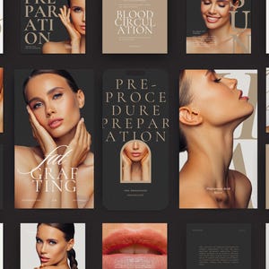 Botox and Filler Instagram Posts | Nurse Injector Instagram Templates | Esthetician Templates Canva | Botox Social Media Templates