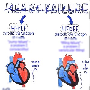 HFrEF frente a HFpEF