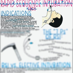 May include: A diagram illustrating the steps involved in rapid sequence intubation (RSI) for emergency airway management. The diagram shows a patient lying on their back with a breathing tube inserted into their mouth. The text explains the process of RSI, which involves the administration of a sedative and paralytic agent to facilitate intubation.