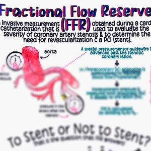 Fractional Flow Reserve