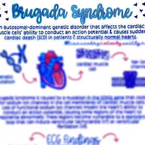 Síndrome de Brugada