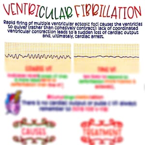 Ventricular Fibrillation (VF)