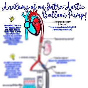Intra-Aortic Balloon Pump (IABP) Anatomy