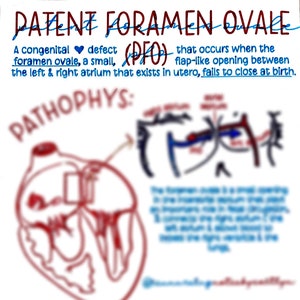 Foramen oval permeable (FOP)