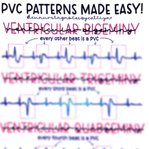 May include: A white background with a blue line EKG pattern. The EKG pattern is labeled with the text "Ventricular Bigeminy", "Ventricular Trigeminy", and "Ventricular Quadgeminy". Each label has an arrow pointing to the EKG pattern and text describing the pattern. The text "every other beat is a PVC", "every third beat is a PVC", and "every fourth beat is a PVC" are included in the image.