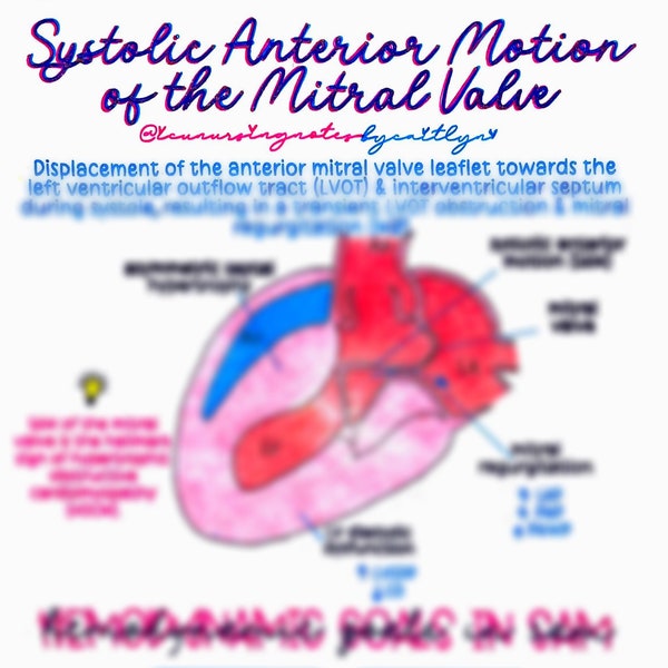 Systolic Anterior Motion (SAM) of the Mitral Valve