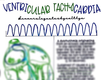 Könnte beinhalten: Ein Diagramm eines Herzens mit einer blauen Linie, die den Weg der elektrischen Impulse während einer ventrikulären Tachykardie verfolgt. Das Diagramm wird von einem Graphen begleitet, der die elektrische Aktivität des Herzens während einer ventrikulären Tachykardie zeigt. Der Text "VENTRICULAR TACHYCARDIA" steht oben im Bild.