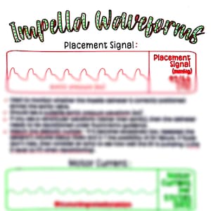 Impella Waveforms