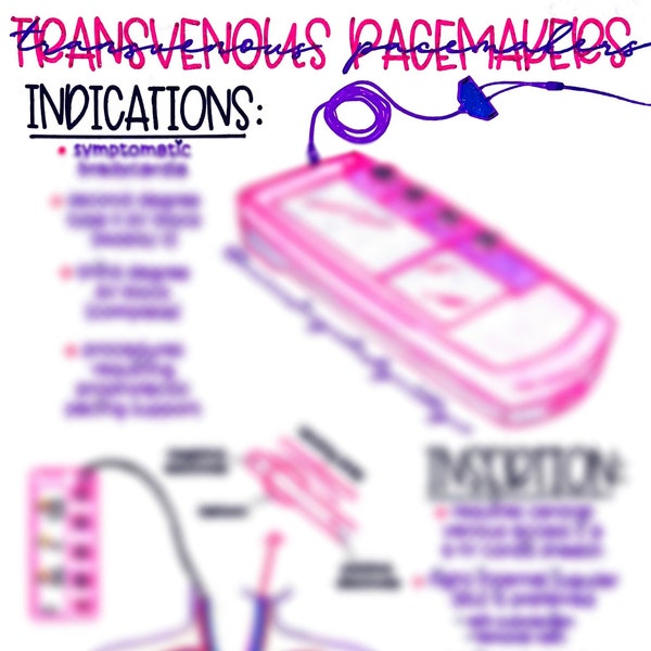 Indicaciones e inserción de estimulación transvenosa