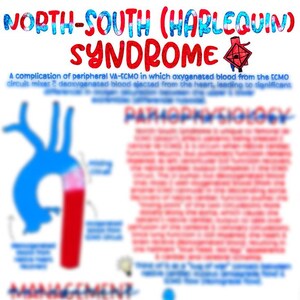 North-South (Harlequin) Syndrome