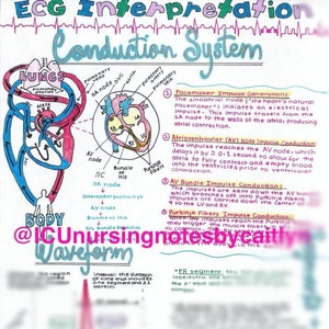 Basics of ECG Interpretation