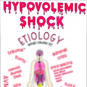 May include: A diagram illustrating the causes of hypovolaemic shock. The diagram shows a human figure with internal organs labelled. The causes of hypovolaemic shock are listed around the figure, including trauma, burns, haemorrhage, and third spacing.