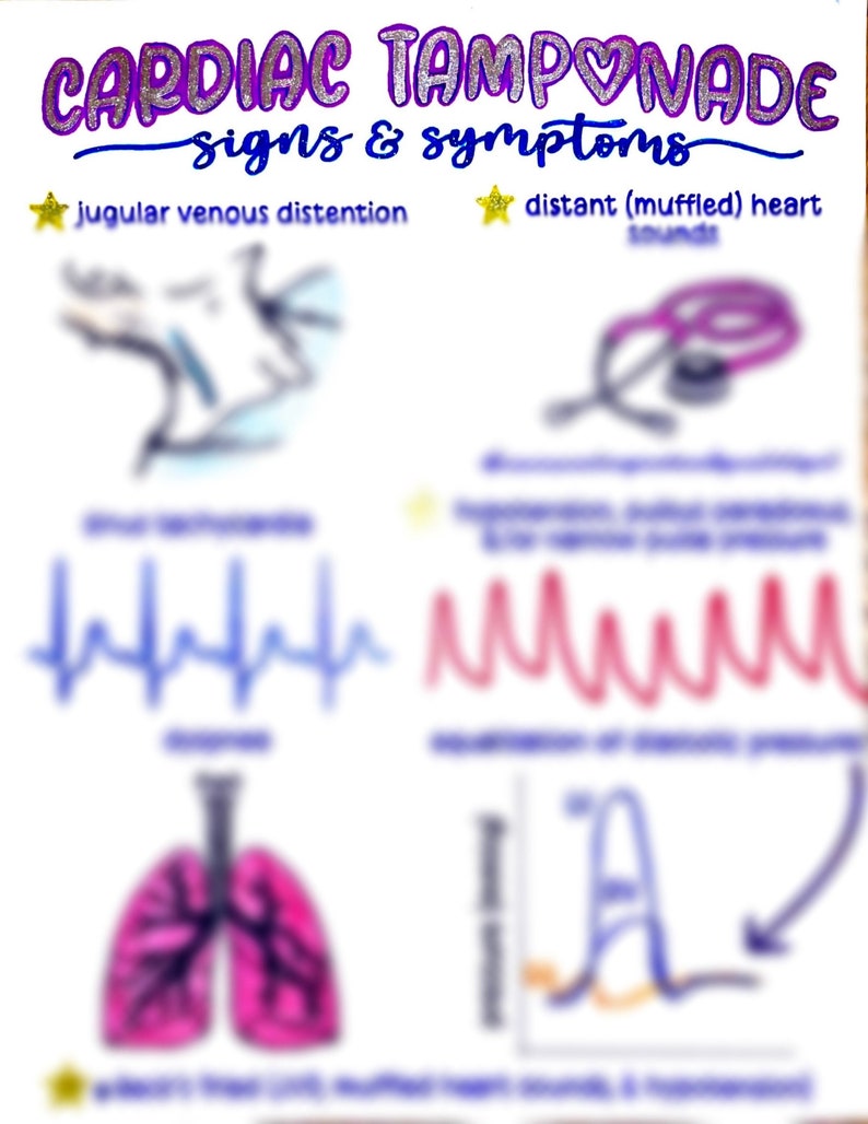Cardiac Tamponade: Signs & Symptoms - Etsy