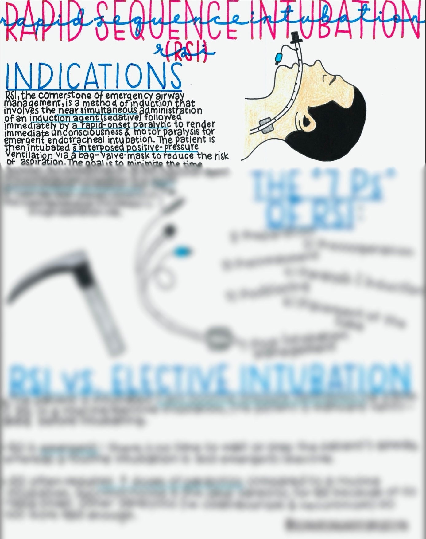 Rapid Sequence Intubation Rsi Etsy