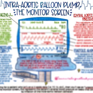 Intraaortic Ballon Pump (IABP) Wellenformen